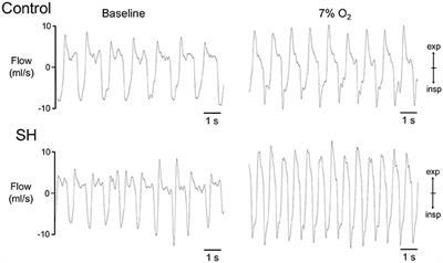 Short-Term Sustained Hypoxia Elevates Basal and Hypoxia-Induced Ventilation but Not the Carotid Body Chemoreceptor Activity in Rats